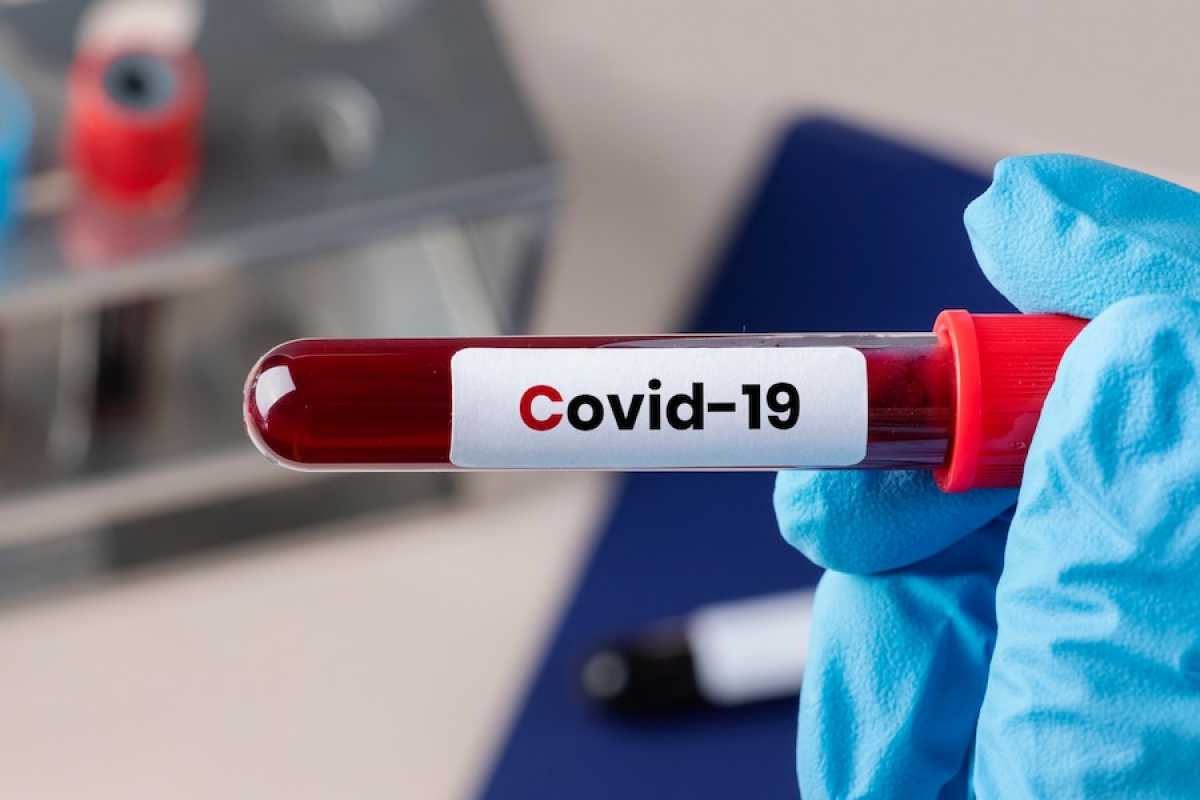 66 казахстанцев заболели коронавирусом за сутки