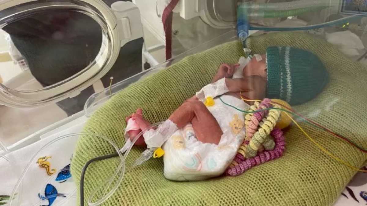 Алматинские медики спасли младенца с врожденным токсоплазмозом