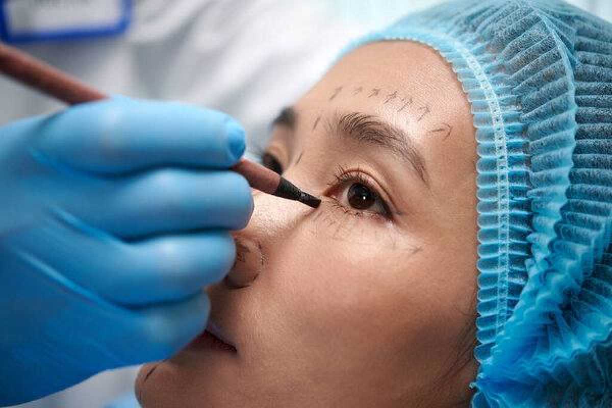 Женщина ослепла на один глаз после блефаропластики в Шымкенте